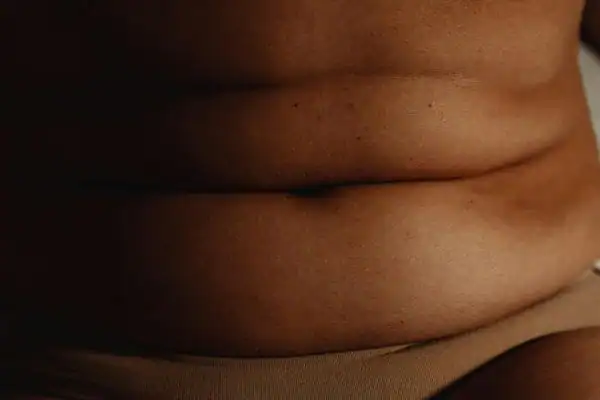 The Hidden Connection: How Stress Shapes Your Fitness and Body Composition 3 image of what stress can do on the stomach area and how Lipo 360 Earl Shilton can help to change your body shape.