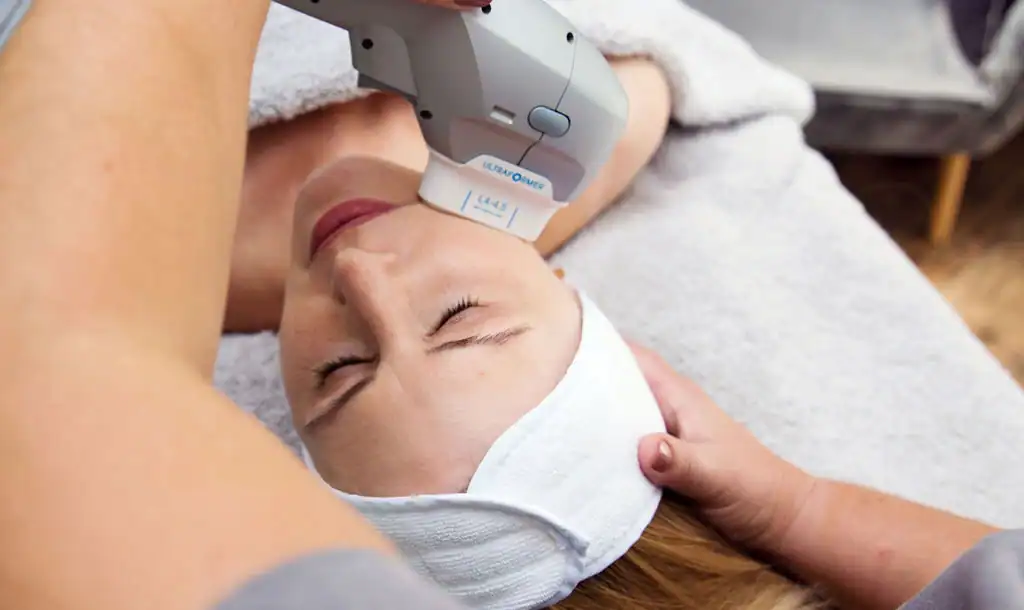 Discover the Perfect Duo: RF Microneedling and HIFU 1 Image of Morpheus8 And HIFU Earl Shilton combined treatment